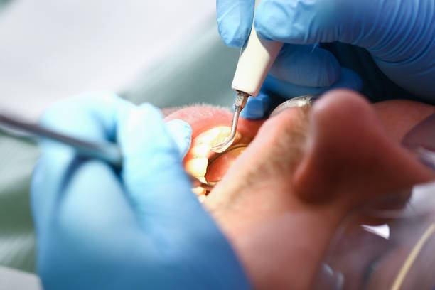 Best Broken or Cracked Tooth Emergency Dentist in Kingston, IL