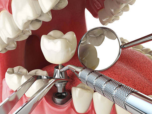 Best Holiday Emergency Dentist in Kingston, IL